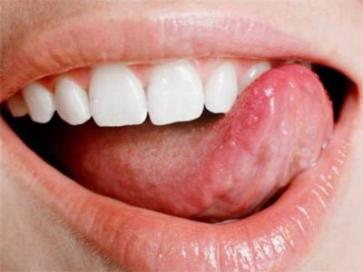 «Γιατρέ τρίζω τα δόντια μου»