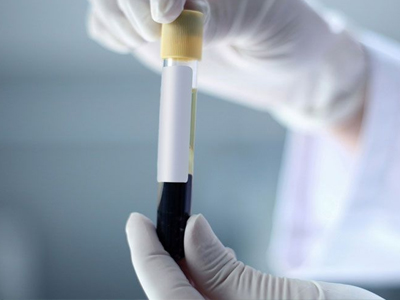 Δωρεάν εξετάσεις σε δικαιούχους του «ΜΑΖΙ»