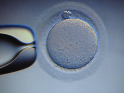 Γονιμότητα: «Κακές» συνήθειες πριν την εξωσωματική γονιμοποίηση