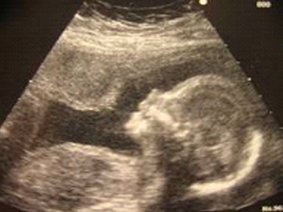 Οι αισθήσεις του εμβρύου σας…