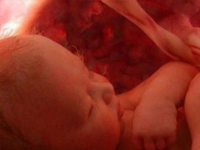 Νέα τεχνική προεμφυτευτικού γενετικού ελέγχου