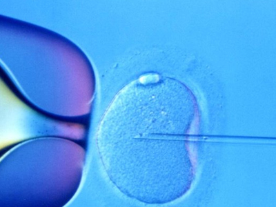 Γονιμότητα: Ένα έμβρυο κάθε φορά!