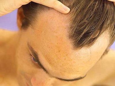 SEXUALITY: Θα μείνω φαλακρός αν κάνω κάθε μέρα σεξ;