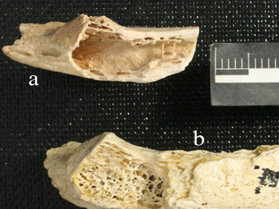 Έρευνα: Οι Νεάντερταλ είχαν όγκους