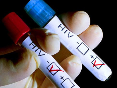 SEXUALITY: Τα άτομα με HIV έχουν υψηλότερο κίνδυνο για εμφάνιση καρκίνου