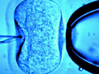 Γονιμότητα: Πέντε εκατομμύρια παιδιά έχουν γεννηθεί έπειτα από IVF