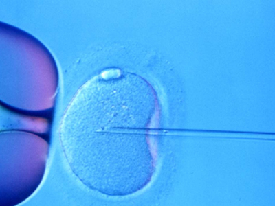 Γονιμότητα: Γιατί η επιτυχία της IVF «πέφτει» μετά τα 35 έτη;