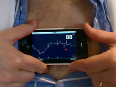 Με τι σχετίζονται οι αρρυθμίες της καρδιάς;