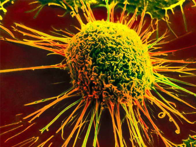 Ταξικές διακρίσεις κάνει ο… καρκίνος