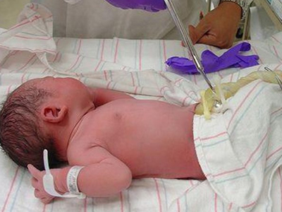 Γονιμότητα: Το καθυστερημένο «κόψιμο» του λώρου είναι ευεργετικό για τα μωρά