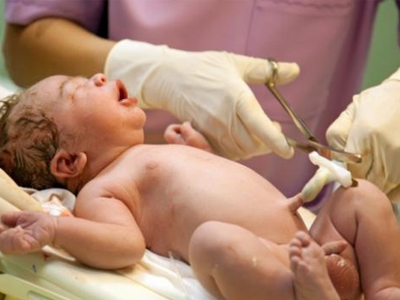 Πότε πρέπει να κόβεται ο ομφάλιος λώρος;