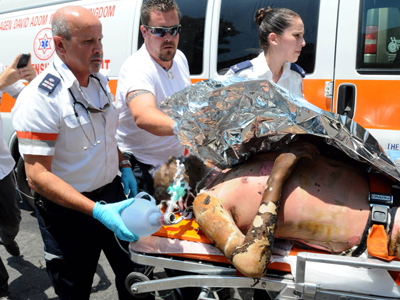 Πέθανε Ισραηλινός που αυτοπυρπολήθηκε λόγω οικονομικών προβλημάτων