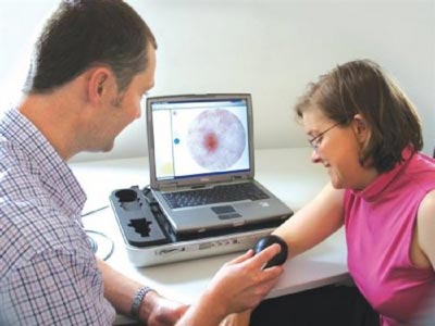 Μελανώματα: Μάθετε πώς να προστατεύετε το σώμα σας