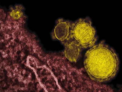 Σ. Αραβία: Εντοπίστηκαν 11 νέα κρούσματα του MERS