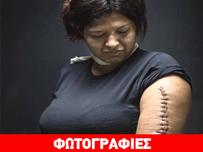 Μεξικό: Μετανάστες κακοποιούνται, ακρωτηριάζονται και χάνουν τη ζωή τους