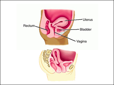 Γονιμότητα: Τι σημαίνει η οπίσθια κλίση της μήτρας;