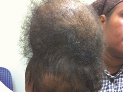 Αυστραλία: «Ιατρικό θαύμα» από ομογενή νευροχειρουργό