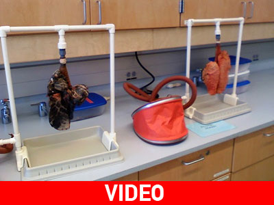 Πνεύμονας καπνιστή VS Πνεύμονα μη καπνιστή: 0-1