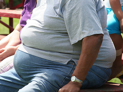 Οι παχύσαρκοι μπορεί να εμφανίσουν πολύποδες του παχέος εντέρου