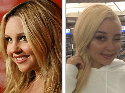 «Έκανα πλαστική!»