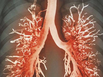 Εμβολιαστείτε κατά του πνευμονόκοκκου