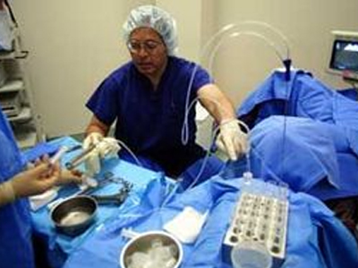 Γονιμότητα: Εγκυμοσύνη μετά από κατάψυξη και μεταμόσχευση ωοθήκης