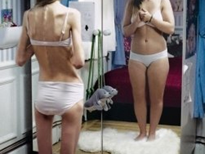 SEXUALITY: Η ψυχογενής ανορεξία και η σεξουαλικότητα