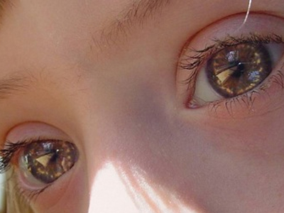 Γονιμότητα: Παγκόσμια ημέρα για το σύνδρομο Down