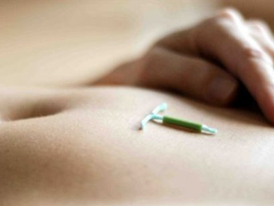 Γονιμότητα: Το ορμονικό σπιράλ είναι χρήσιμο σε πολλές καλοήθεις παθήσεις