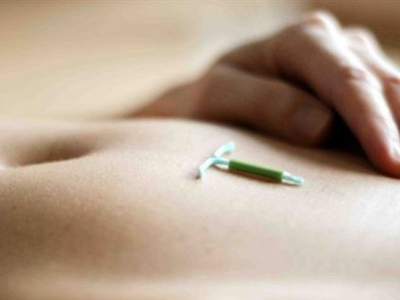 Γονιμότητα: Το σπιράλ είναι πιο αποτελεσματικό από το χάπι της επόμενης μέρας