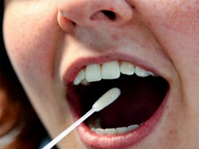 Νέο τεστ σάλιου υπόσχεται έγκαιρη διάγνωση του καρκίνου Νέο τεστ σάλιου υπόσχεται έγκαιρη διάγνωση του καρκίνου