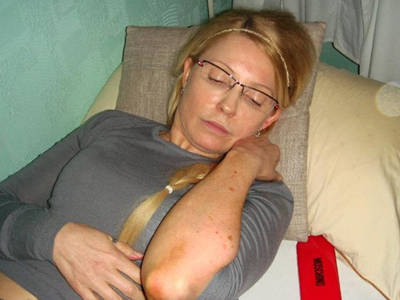 Η κατάσταση της Τιμοσένκο προκαλεί ανησυχία στους οικείους της