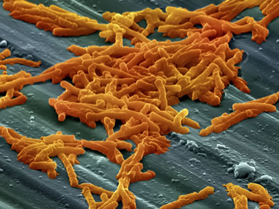 Ανακαλύφθηκε η «βιολογική αλχημεία» των βακτηρίων της λέπρας