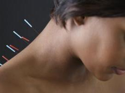 Γονιμότητα: Ο βελονισμός δεν είναι χρήσιμος στις γυναίκες με ΣΠΩ