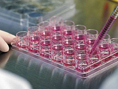 Χρήση βλαστοκυττάρων κατά του Πάρκινσον