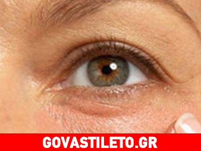 Εξαφάνισε μαύρους κύκλους και ρυτίδες