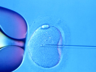 Οι κίνδυνοι της ICSI