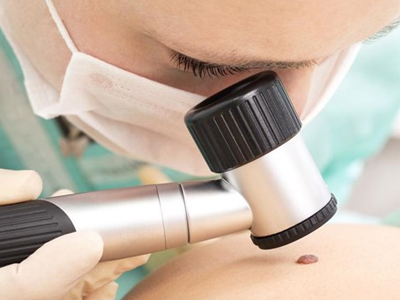 Το μελάνωμα απειλεί τους νεαρούς άνδρες