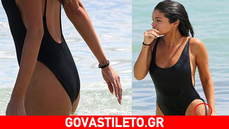 Selena Gomez- ετών 23: Ναι μεν αδυνάτισε αλλά γέμισε ραγάδες