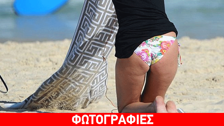 Ποιο μοντέλο της «Victoria’s Secret» έχει κυτταρίτιδα;