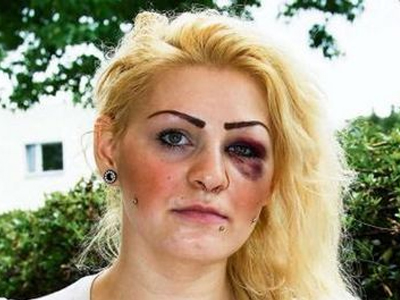 Ελληνογερμανίδα γρονθοκοπήθηκε στο Βερολίνο γιατί πανηγύρισε!