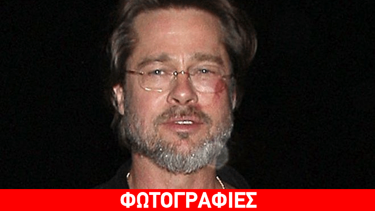 Brad Pitt: Με τραύματα στο πρόσωπο σε φιλανθρωπικό event