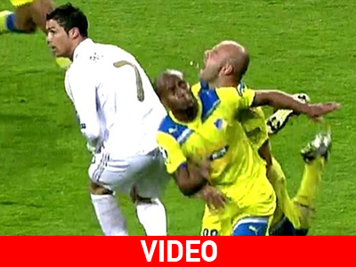 Έχασε τρία δόντια στο «Σαντιάγκο Μπερναμπέου»