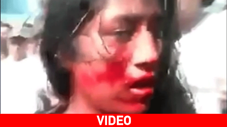 Σοκ: Έκαψαν ζωντανή μια 16χρονη- Την κατηγόρησαν ότι σκότωσε ταξιτζή