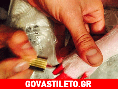 Γνωστή τραγουδίστρια αγόρασε γουρούνι και του βάφει τα νύχια κόκκινα!