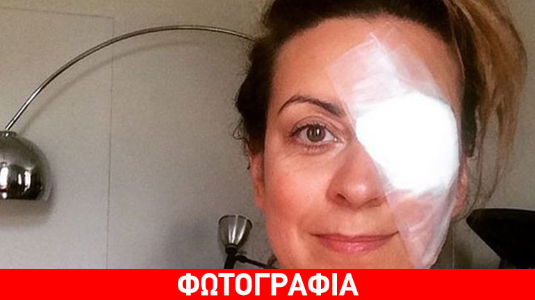Ευαγγελία Μουμούρη: Υπεβλήθη σε χειρουργική επέμβαση στο μάτι!