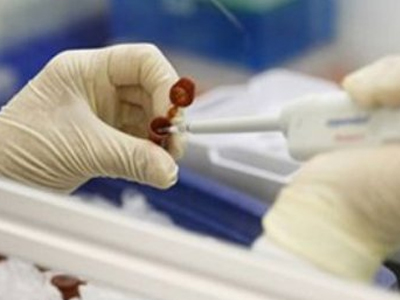 Ελπίδες για τον καρκίνο των νεφρών