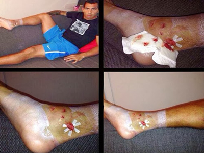 Σοκ με τη φωτογραφία του Τέβες