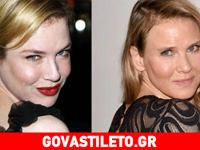 Δείτε νέες φωτογραφίες της σχεδόν αγνώριστης Ρενέ Ζελβέγκερ