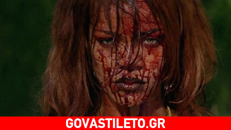 Αιμόφυρτη η Rihanna-Τι συνέβη